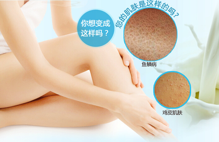 吃什么藥能治魚鱗病，參歸潤燥搽劑怎么樣